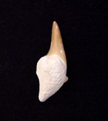 Pathologic Teeth