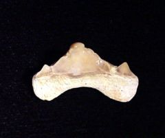 Pathologic Teeth