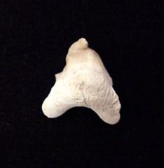 Pathologic Teeth