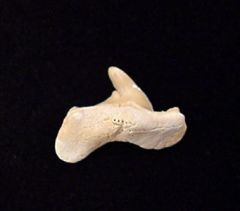 Pathologic Teeth