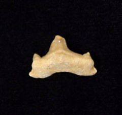 Pathologic Teeth