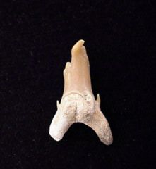 Pathologic Teeth