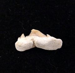 Pathologic Teeth