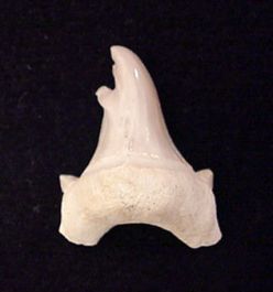 Pathologic Teeth